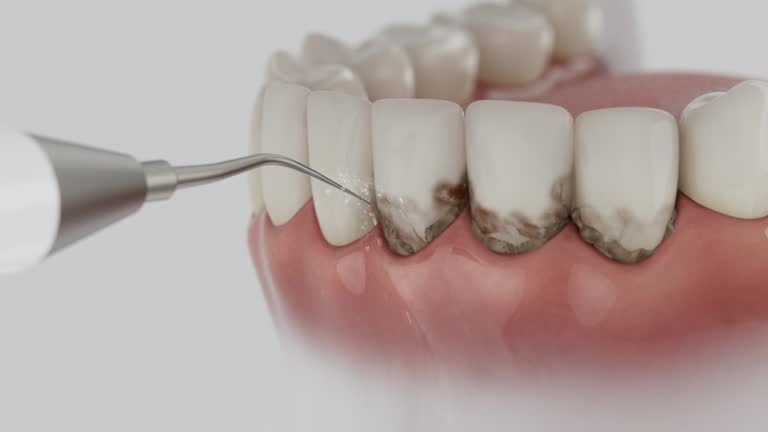 Trusted Emergency Dentist service in Mifflinburg, PA - Dentist Open Now